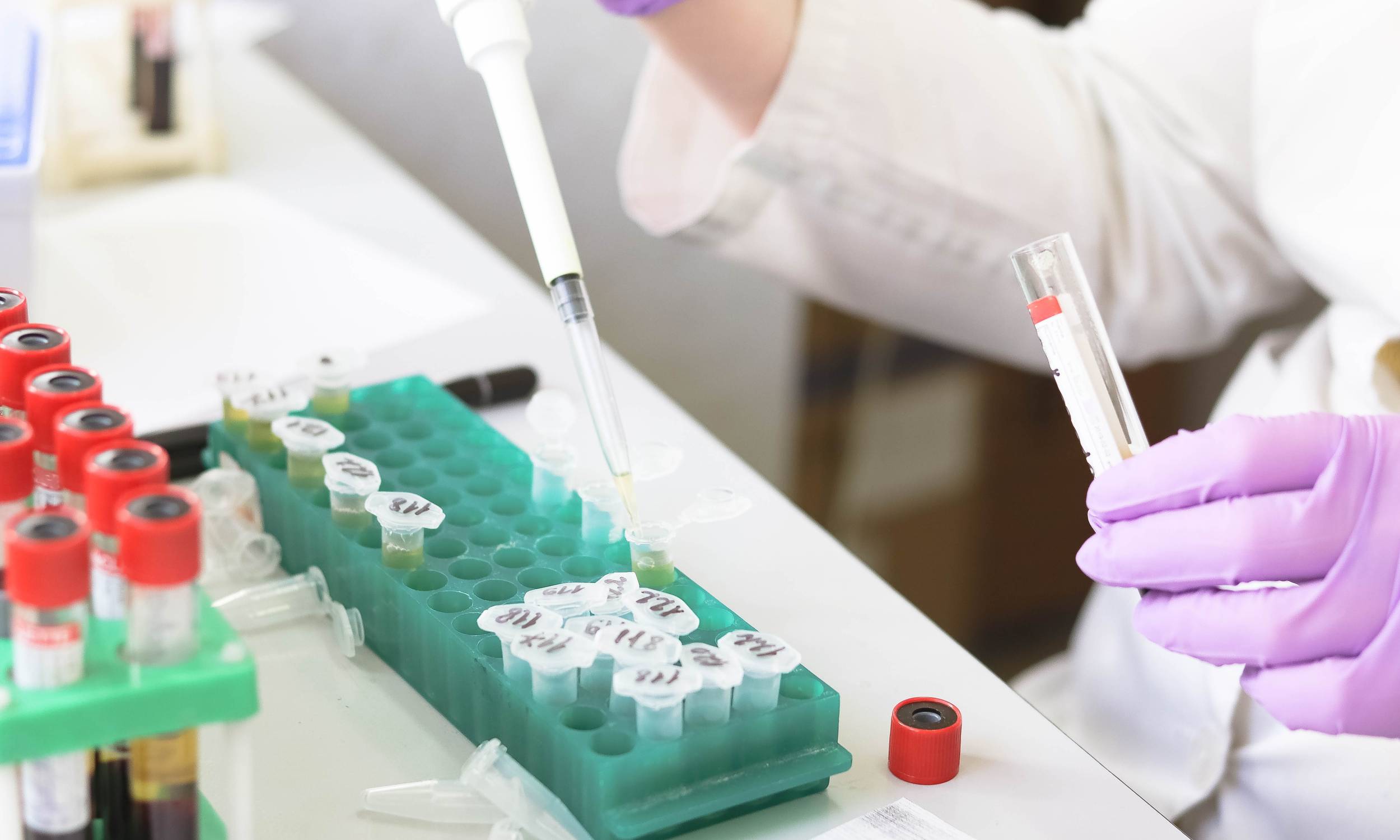 Ceny badań w górę. Wiadomo, o ile podrożeją